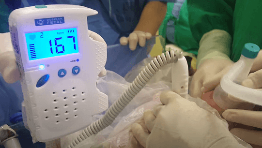 Neonatal Resuscitation