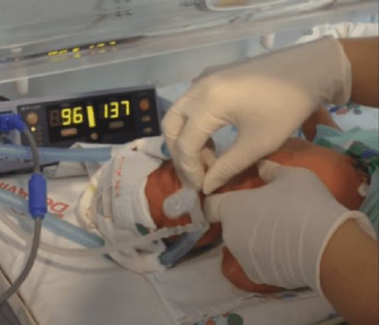 Neonatal Digital intubation by a First Year Fellow